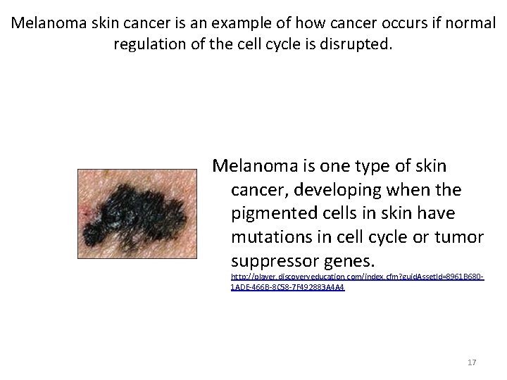 Melanoma skin cancer is an example of how cancer occurs if normal regulation of Melanoma skin cancer is an example of how cancer occurs if normal regulation of