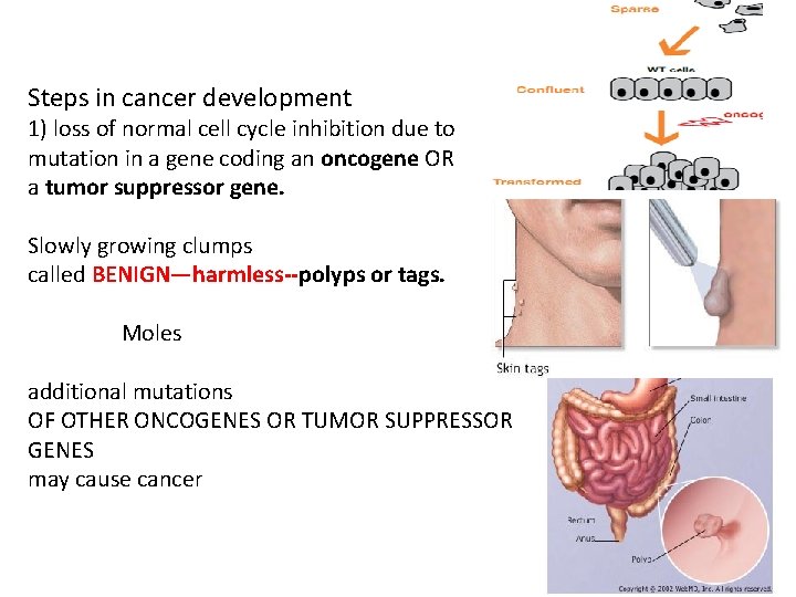 Steps in cancer development 1) loss of normal cell cycle inhibition due to mutation Steps in cancer development 1) loss of normal cell cycle inhibition due to mutation