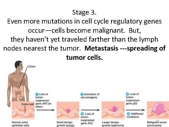 Stage 3. Even more mutations in cell cycle regulatory genes occur—cells become malignant. But, Stage 3. Even more mutations in cell cycle regulatory genes occur—cells become malignant. But,