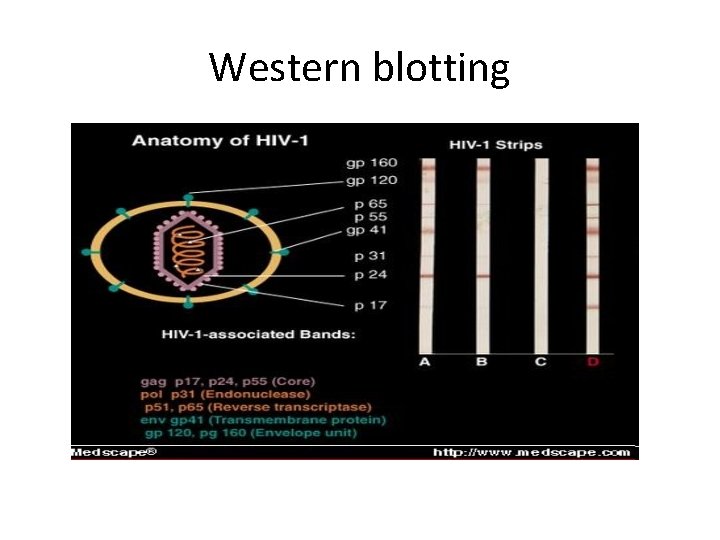 Western blotting 