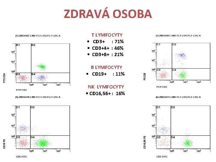 ZDRAVÁ OSOBA T LYMFOCYTY • CD 3+ : 71% • CD 3+4+ : 46%