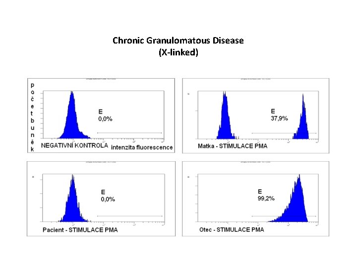 Chronic Granulomatous Disease (X-linked) 