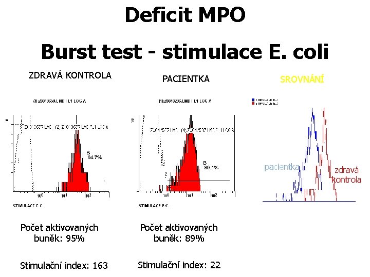 Deficit MPO Burst test - stimulace E. coli ZDRAVÁ KONTROLA PACIENTKA SROVNÁNÍ pacientka Počet