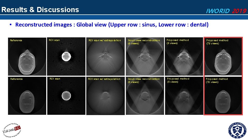 Results & Discussions IWORID 2019 • Reconstructed images : Global view (Upper row :