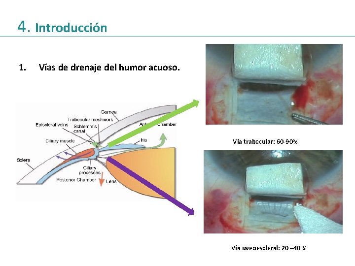 4. Introducción 1. Vías de drenaje del humor acuoso. Vía trabecular: 60 -90% Vía