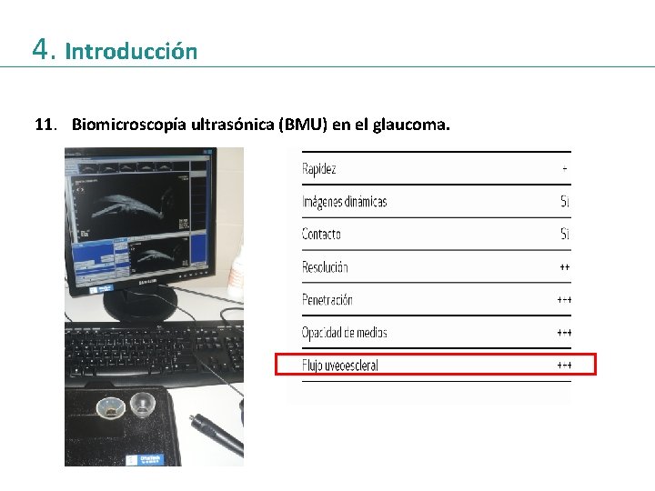 4. Introducción 11. Biomicroscopía ultrasónica (BMU) en el glaucoma. 