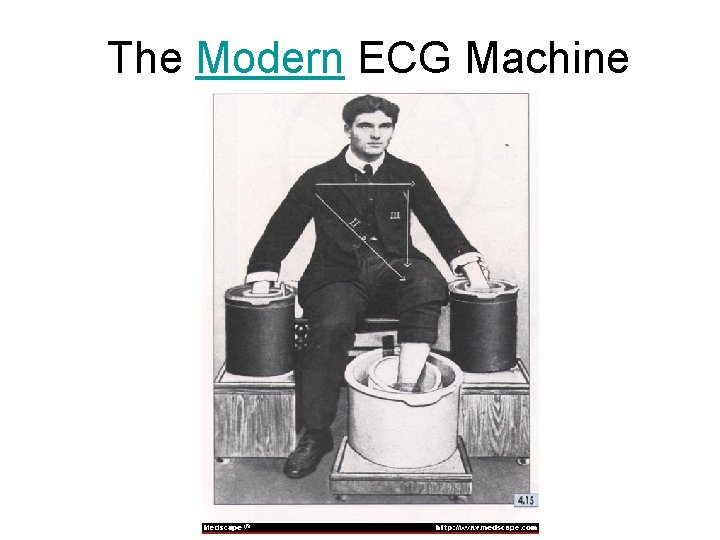 The Modern ECG Machine 