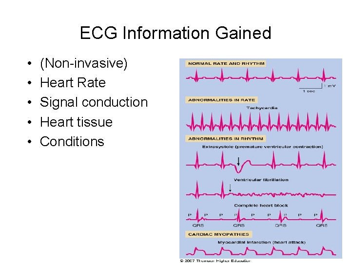 ECG Information Gained • • • (Non-invasive) Heart Rate Signal conduction Heart tissue Conditions