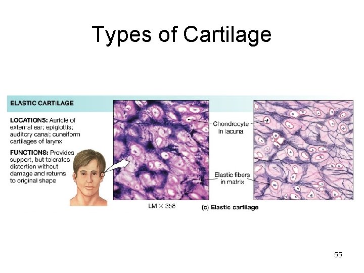 Types of Cartilage 55 