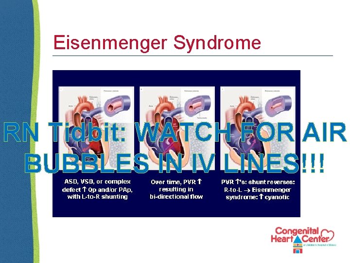 Eisenmenger Syndrome RN Tidbit: WATCH FOR AIR BUBBLES IN IV LINES!!! 