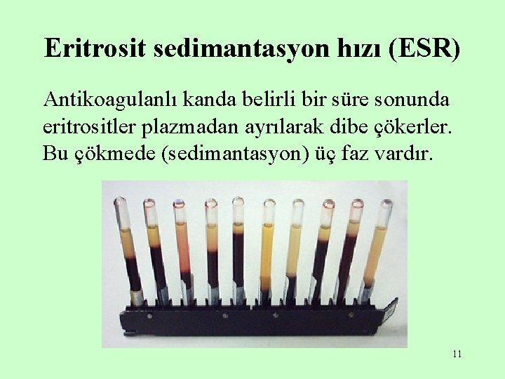 Eritrosit sedimantasyon hızı (ESR) Antikoagulanlı kanda belirli bir süre sonunda eritrositler plazmadan ayrılarak dibe