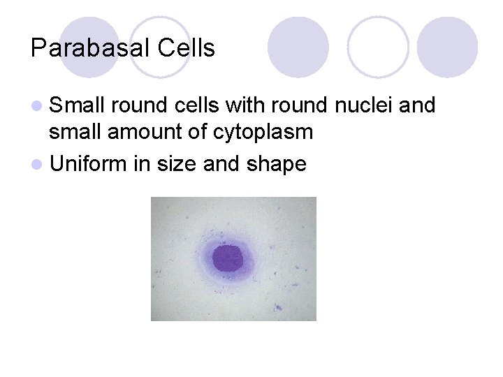 Parabasal Cells l Small round cells with round nuclei and small amount of cytoplasm
