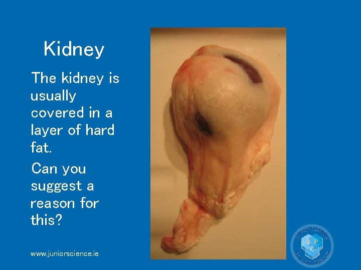Kidney The kidney is usually covered in a layer of hard fat. Can you