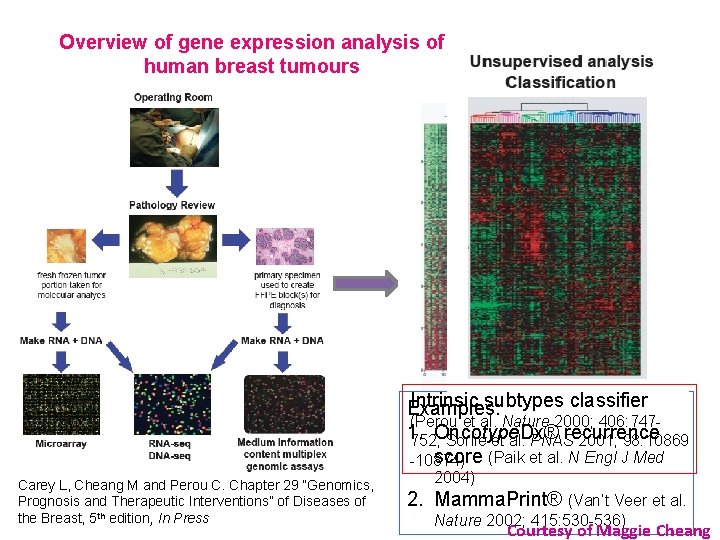Overview of gene expression analysis of human breast tumours Intrinsic subtypes classifier Examples: (Perou