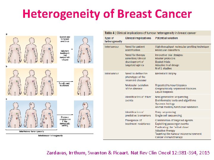 Heterogeneity of Breast Cancer Zardavas, Irrthum, Swanton & Picaart. Nat Rev Clin Oncol 12: