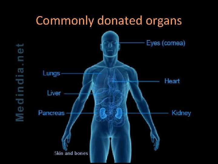 Commonly donated organs Skin and bones 