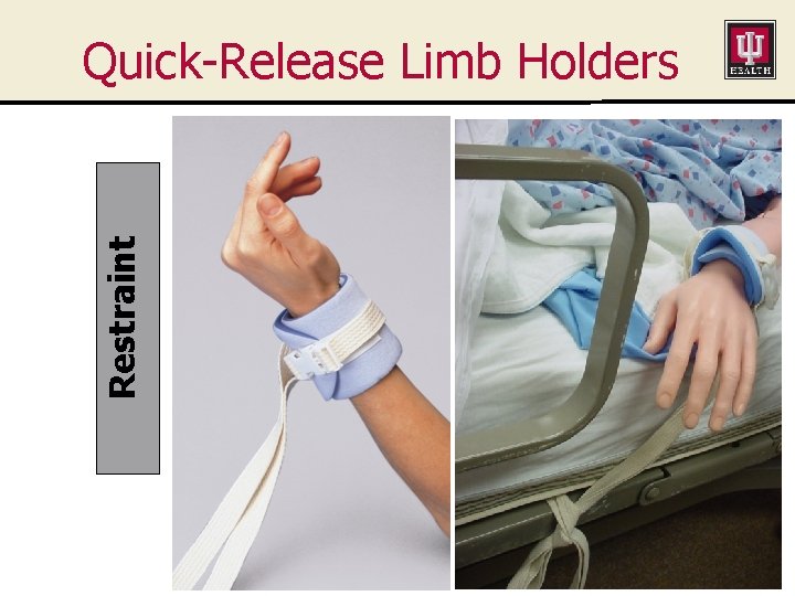 Restraint Quick-Release Limb Holders 
