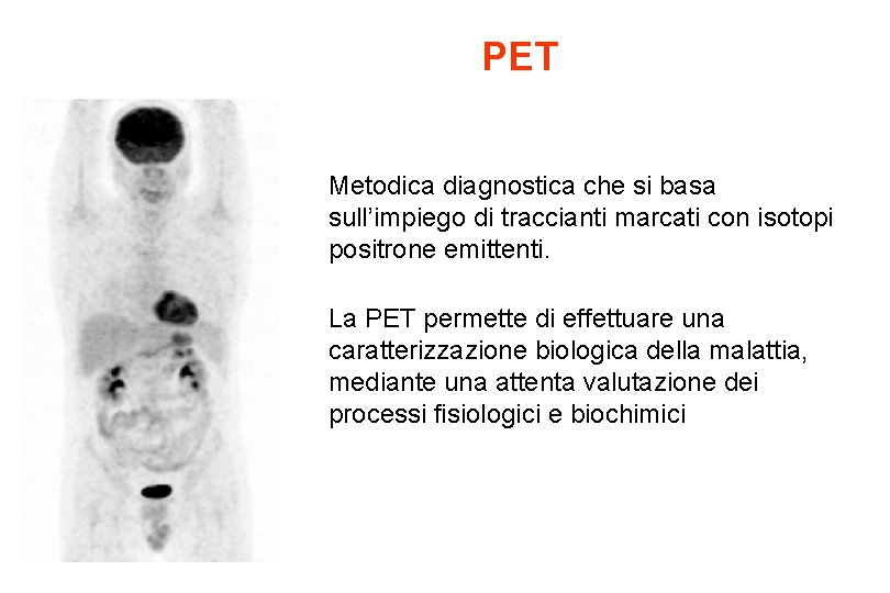 PET Metodica diagnostica che si basa sull’impiego di traccianti marcati con isotopi positrone emittenti.