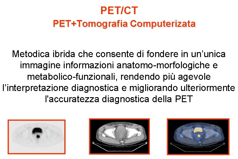 PET/CT PET+Tomografia Computerizata Metodica ibrida che consente di fondere in un’unica immagine informazioni anatomo-morfologiche