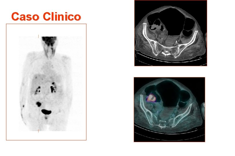 Caso Clinico 