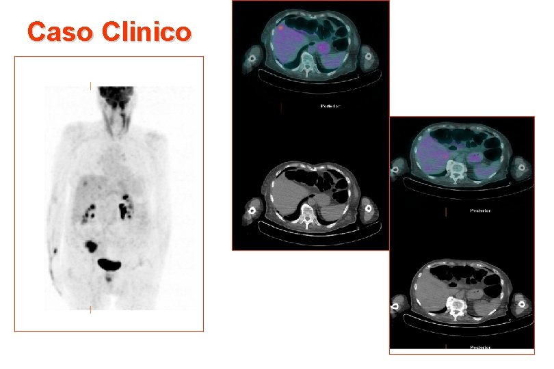Caso Clinico 