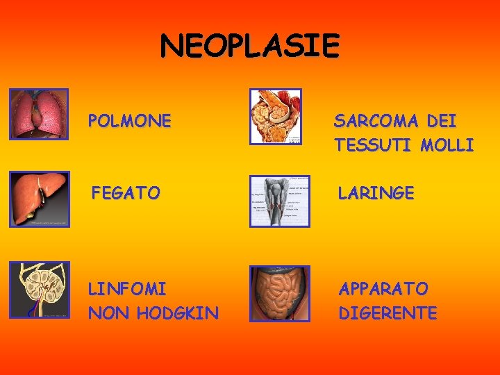 NEOPLASIE POLMONE SARCOMA DEI TESSUTI MOLLI FEGATO LARINGE LINFOMI NON HODGKIN APPARATO DIGERENTE 