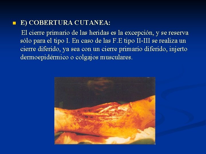 n E) COBERTURA CUTANEA: El cierre primario de las heridas es la excepción, y