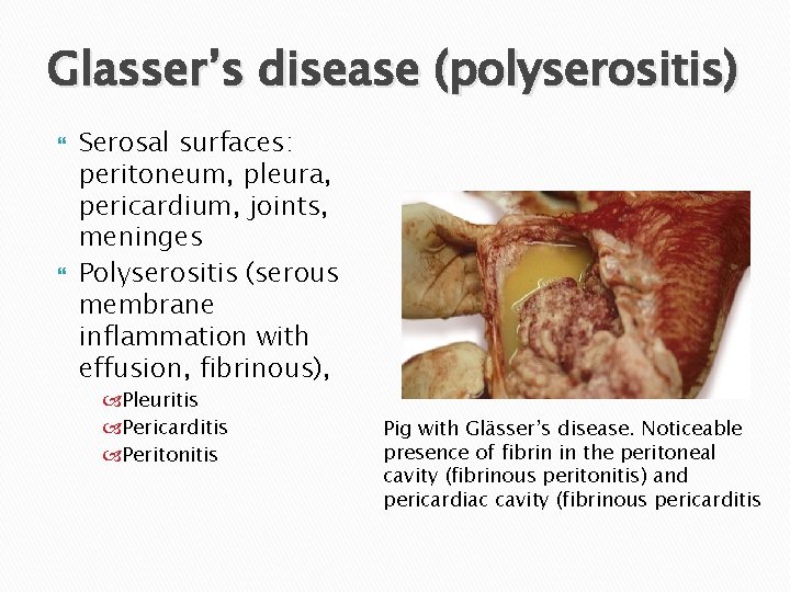 Glasser’s disease (polyserositis) Serosal surfaces: peritoneum, pleura, pericardium, joints, meninges Polyserositis (serous membrane inflammation