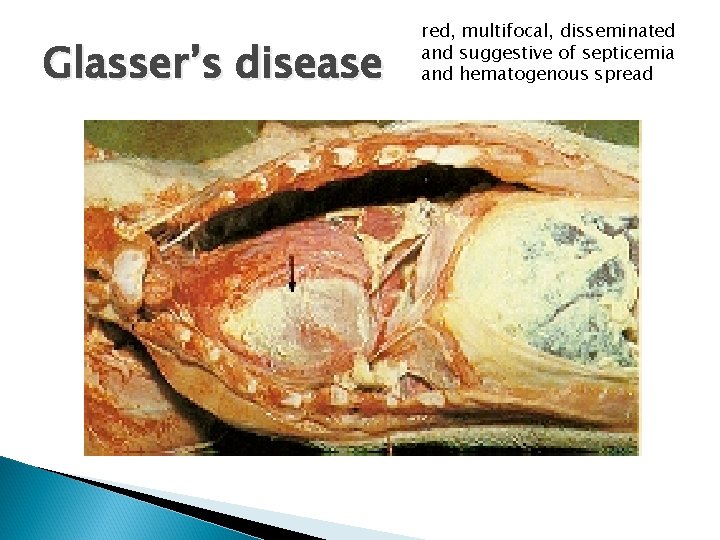 Glasser’s disease red, multifocal, disseminated and suggestive of septicemia and hematogenous spread 