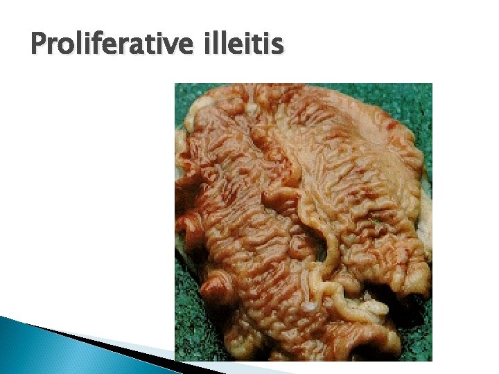 Proliferative illeitis 