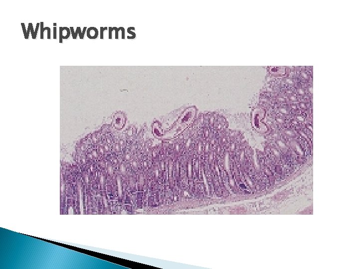 Whipworms 