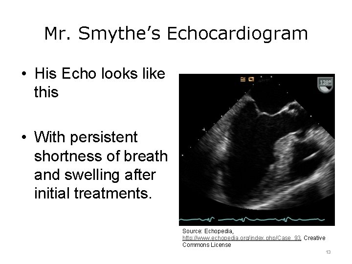 Mr. Smythe’s Echocardiogram • His Echo looks like this • With persistent shortness of