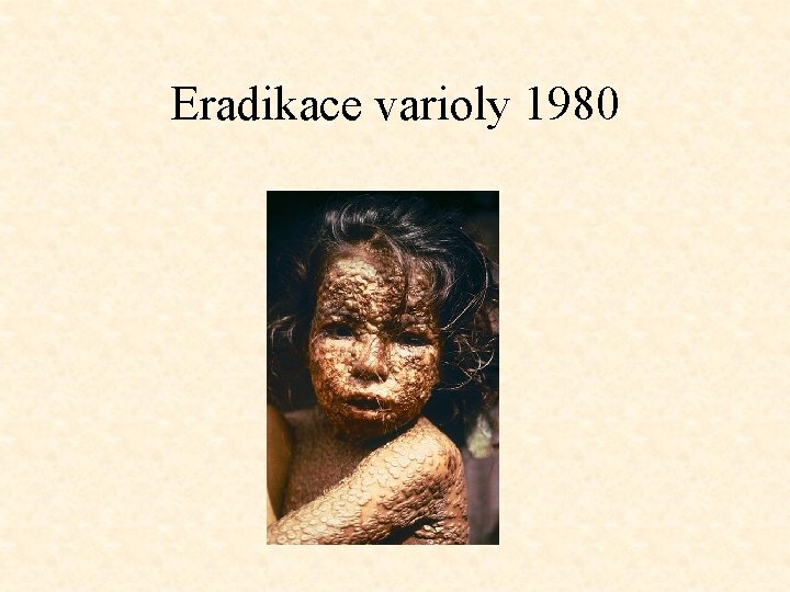 Eradikace varioly 1980 