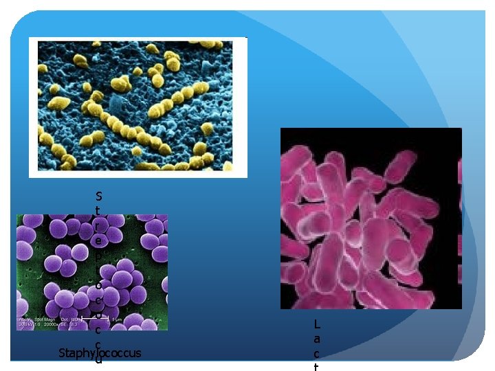 S t r e p t o c c Staphylococcus u L a c