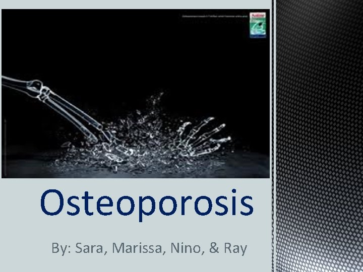 Osteoporosis By: Sara, Marissa, Nino, & Ray 