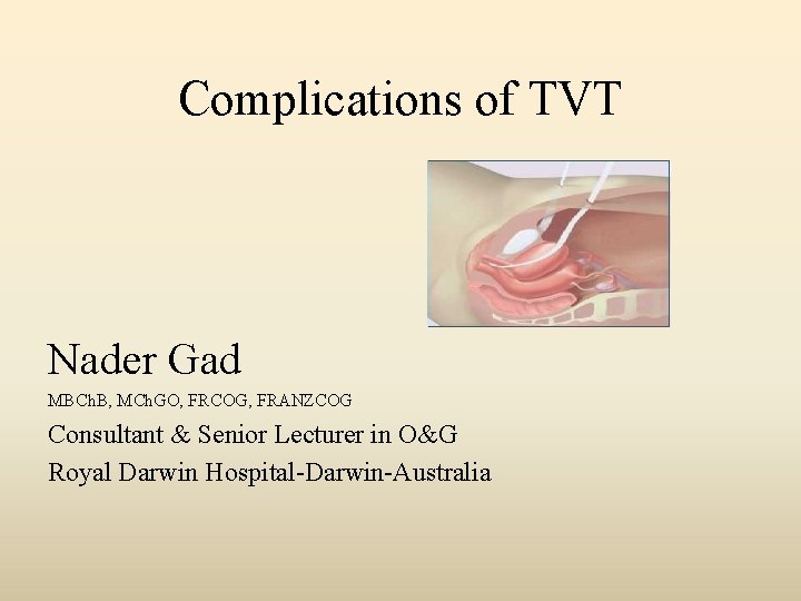 Complications of TVT Nader Gad MBCh. B, MCh. GO, FRCOG, FRANZCOG Consultant & Senior