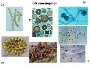 Stramenopiles 28 29 32 33 30 31 STRAMENOPILES