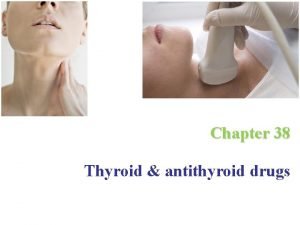 Chapter 38 Thyroid antithyroid drugs Thyroid gland The