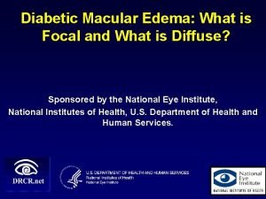 Diabetic Macular Edema What is Focal and What