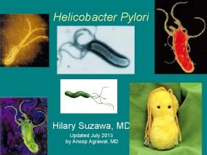 Helicobacter Pylori Hilary Suzawa MD Updated July 2013