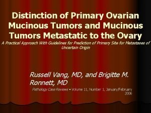 Distinction of Primary Ovarian Mucinous Tumors and Mucinous