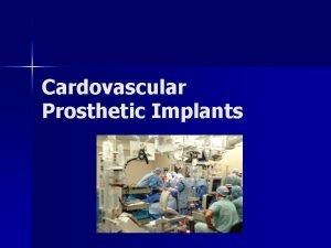 Cardovascular Prosthetic Implants Types of Cardiac Implants Prosthetic