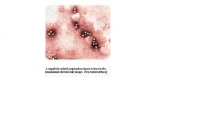 A negatively stained preparation of parvovirus seen by