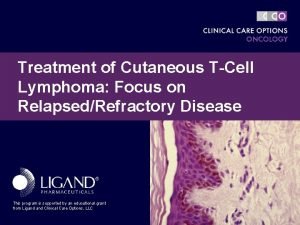 Treatment of Cutaneous TCell Lymphoma Focus on RelapsedRefractory