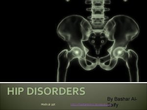 HIP DISORDERS Medical ppt By Bashar Alhttp hastaneciyiz