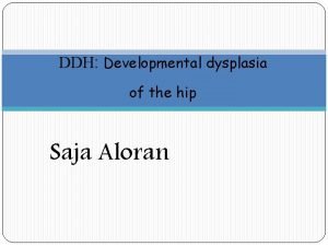 DDH Developmental dysplasia of the hip Saja Aloran