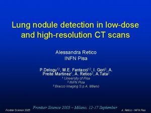 Lung nodule detection in lowdose and highresolution CT