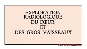 Echo doppler cardiaque Echo doppler cardiaque