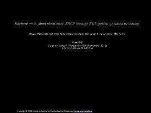 Bilateral metal stent placement ERCP through EUSguided gastroenterostomy