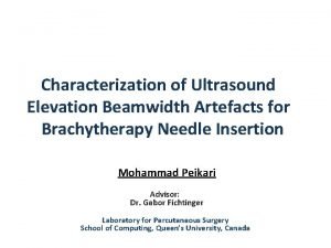 Characterization of Ultrasound Elevation Beamwidth Artefacts for Brachytherapy